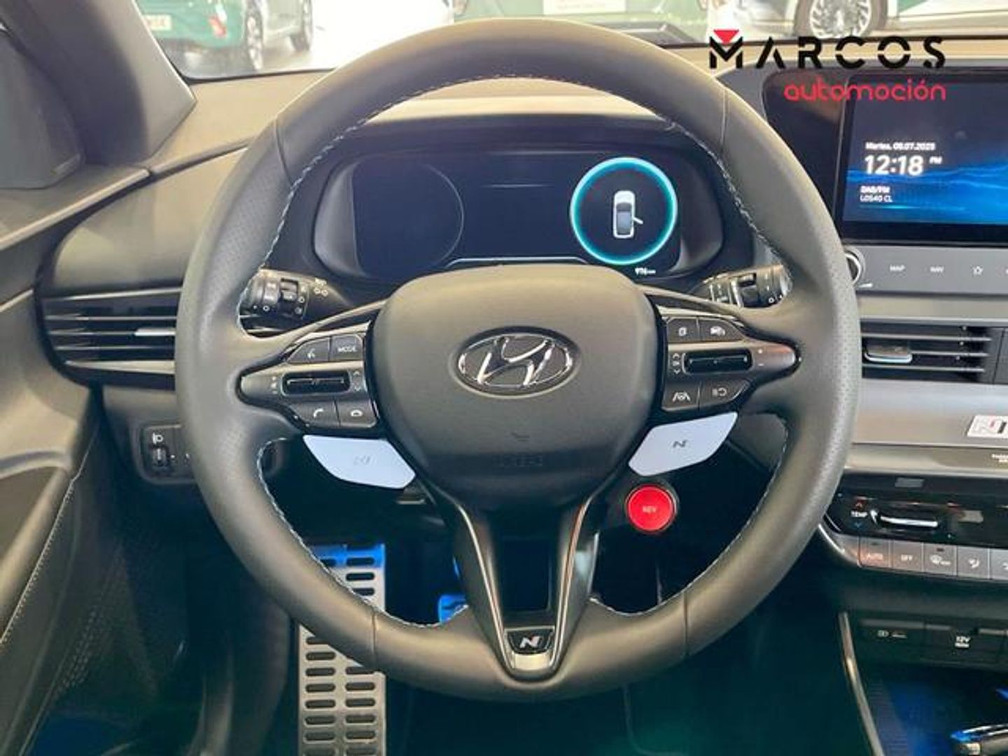 Hyundai i20 1.6T N Copa 150 kW (204 CV)